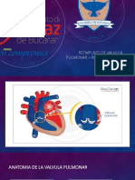 Cambio de Valvula Pulmonar