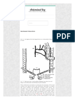 Abdominalkey Com Hartmanns Resection