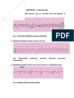 Defibrillation - E-Learning Quiz 1. Identify The Rhythm