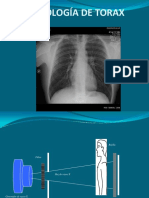 Radiografia Torax