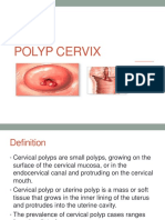 Polyp Cervix