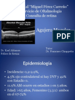 Agujero Macular