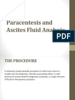 Paracentesis and Acites Fluid