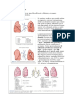 Cancer de Pulmon