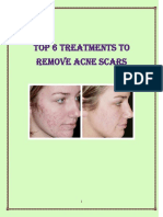 Sean Lowry's-The Fast Home Scar Removal