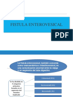 Fistula Vesicointestinales