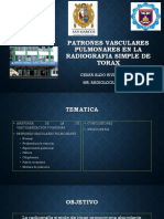 Patrones Vasculares Pulmonares en La Radiografia Simple de Torax