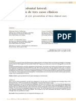 Quiste Periodontal Lateral