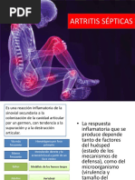 Artritis Infecciosas 123