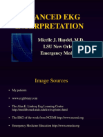 Advanced Ekg Interpretation: Micelle J. Haydel, M.D. LSU New Orleans Emergency Medicine