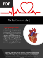 Fibrilación Auricular