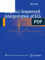 Rui Zeng (Eds.) - Graphics-Sequenced Interpretation of ECG-Springer Singapore (2016) PDF