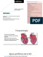 Insuficiencia Aortica