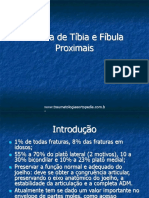 Fraturas de Tíbia e Fíbula Proximais