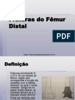 Fraturas Do Fêmur Distal