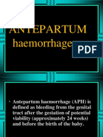 Antepartum Hemorrhage