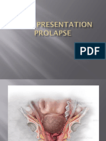 Cord Presentation Prolapse