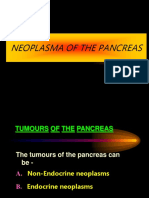 Neoplasma of Pankreas