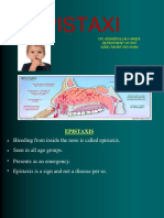 Epistaxi S: Dr. Assaddullah Hamza Department of Ent SZMC Rahim Yar Khan