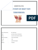 Lesson Plan On DVT