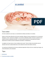 Tumor Cerebral