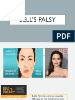 Bells Palsy