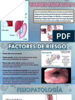 Varices Ensofagica 2019