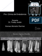 Endodoncia Radiografias