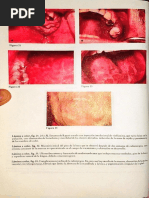 Medicina Bucal de Burket