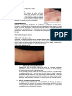 Urticaria Debida La Sudoración o Estrés