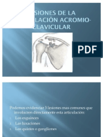 Lesión Acromio Clavicular