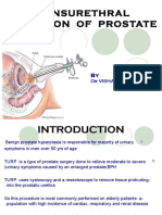 Turp 160328193838