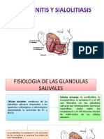 Sialodenitis Sialolitiasis