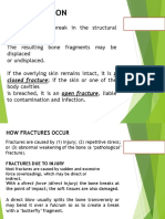 Apley Principles of Fracture