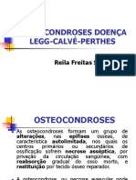 Osteocondroses Doença Legg-Calvé-Perthes