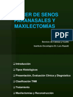 Maxilectomias y Reconstruccion en Cancer de Senos Paranasales