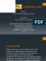 Aspergilloma