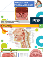 Amigdalitis e Hipertrofia Adenoidea