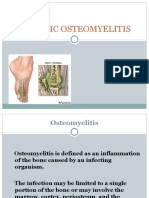 Chronic Osteomyelitis