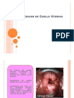 Cancer de Cuello Uterino