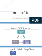 Hidrocefalia