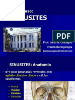 Sinusites