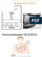 Ecg Cmu