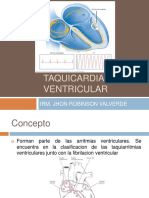 Taquicardiaventricular