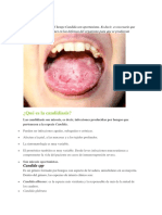 Candidiasis