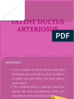 Patent Ductus Arteriosus