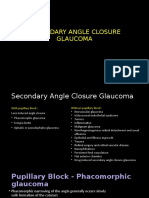 Secondary Angle Closure Glaucoma