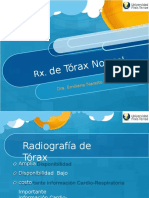 RX de Torax