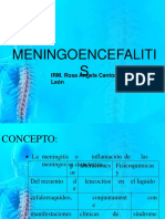 MENINGOENCEFALITIS