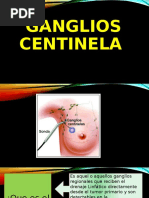 Ganglios Centinela